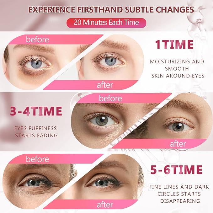 2 Packs 60 Pcs Under Eye Patches, 24K Gold+Pink, 30 Pairs Women Undereye Mask for Puffy Eyes Dark Circles Treatment, Men Collagen Gel Pads Hydrating for Eye Bags Puffiness Wrinkle, Beauty Skin Care-BrightBean Baby