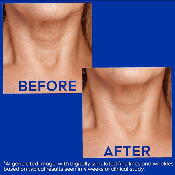 NIVEA Skin Firming & Anti Wrinkle Neck & Chest Cream with Coenzyme Q10, Creatine and Provitamin B5, Skin Firming Cream Reduces the Look of Fine Lines and Wrinkles, 6.7 Oz Tube-BrightBean Baby