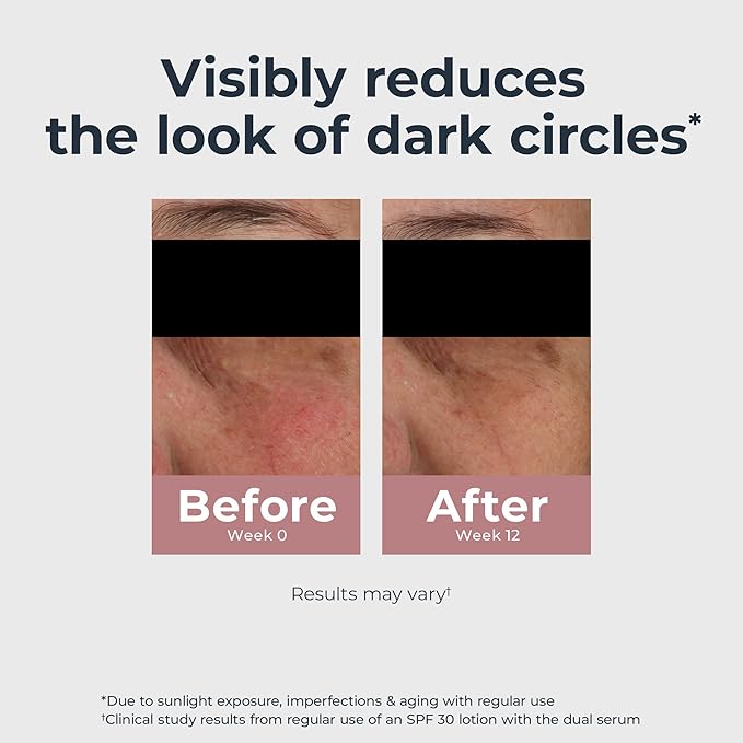 Eucerin Radiant Tone Eye Cream Dark Circle Corrector, Eye Brightening Cream with Thiamidol and Hyaluronic Acid, Helps Reduce the Look of Eye Puffiness, 0.5 Oz Tube-BrightBean Baby