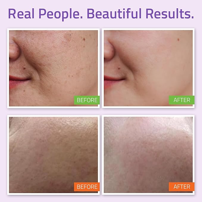 YEOUTH Skin Care Set: Hyaluronic Acid Serum, Vitamin C Serum, Face Cleanser, Toner, Under Eye Gel, Face Cream, 6-Piece Skincare Kit For Women & Men-BrightBean Baby