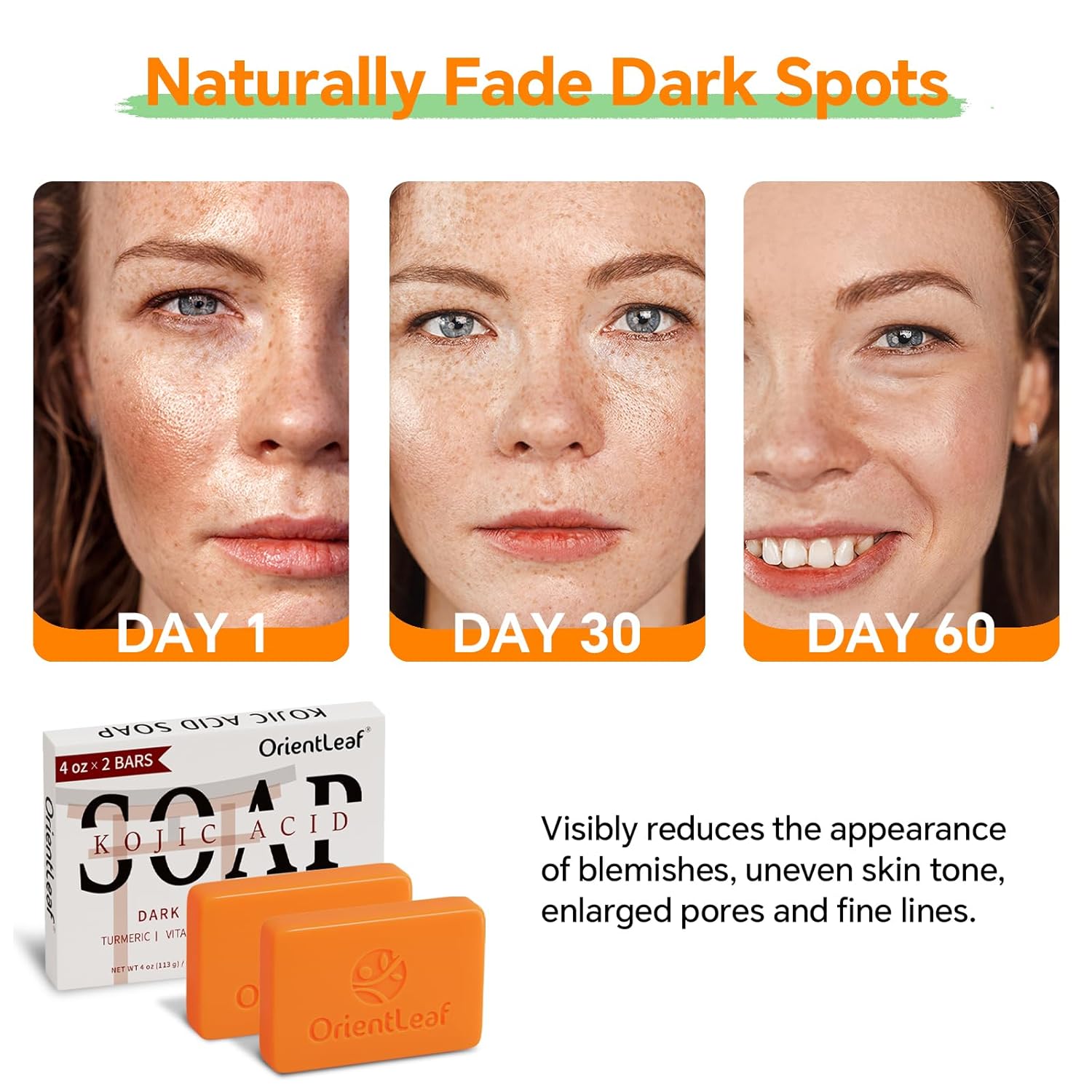 Kojic Acid and Turmeric Soap for Dark Spots Remover, Brightening, Hyperpigmentation for Face, 4oz x 2 BARS-BrightBean Baby