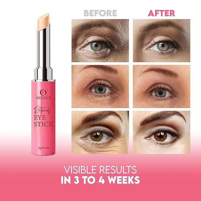 Instant Eye Bag Remover, Retinol Eye Cream for Dark Circles, Under Eye Brightener Stick, Under Eye Cream Anti Aging, Eye Cream for Wrinkles, Brightening Eye Cream for Puffiness and Bags-BrightBean Baby