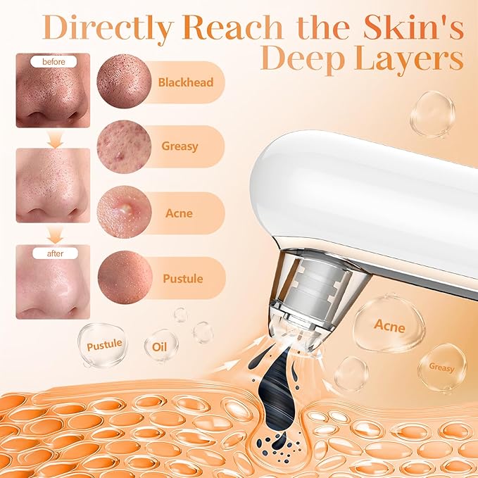 Yccu Blackhead Remover Vacuum Pore Extractor Black Head Remover for Face&Nose Blackhead Extractor Pore Vacuum Pimple Extractor Tool Pore Cleaner with USB Charge 4 Modes 5 Suction Heads for Women&Men-BrightBean Baby