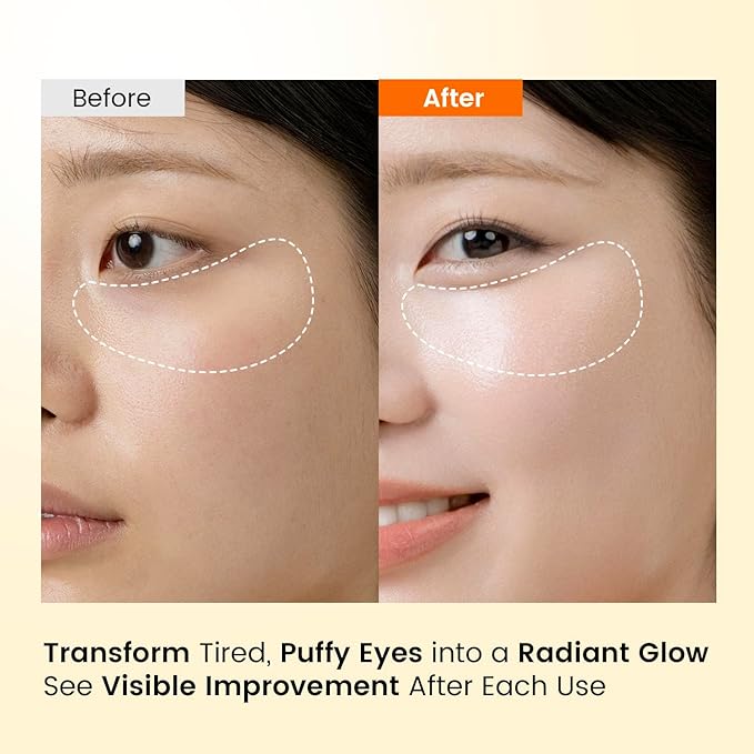 Caffeine Under Eye Patches: 30 Pairs Korean Hydrogel Eye Masks for Dark Circles Puffiness Relief with Niacinamide Hyaluronic Acid - Undereye Brightening Hydrating Anti-Wrinkle Treatment-BrightBean Baby