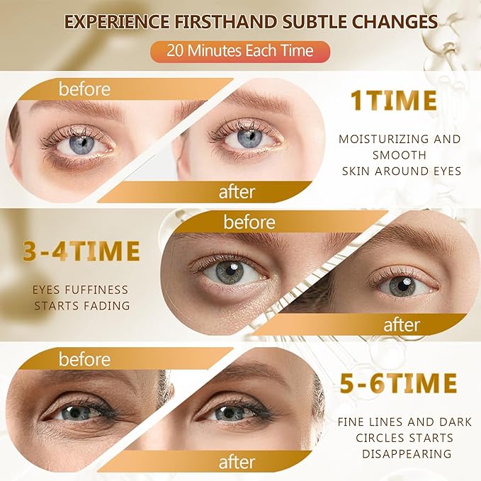 60 Pcs 24K Gold Under Eye Patches with 5 Pieces Travel 24K Golden Eye Mask, 30 Pairs Women Undereye Mask for Dark Circles Puffy Eyes Treatment, Men Gel Pads Hydrating for Puffiness Wrinkle-BrightBean Baby