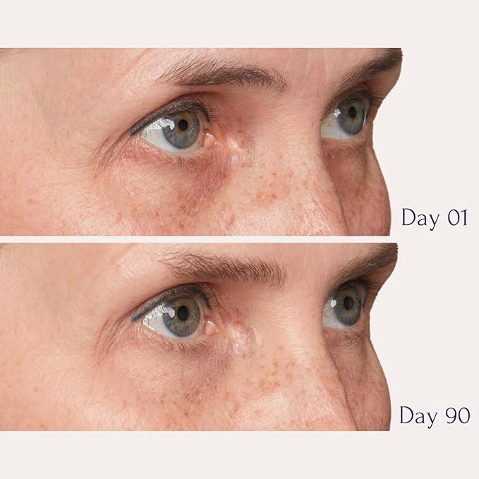 Tru Alchemy Eye Elixir Cooling Eye Treatment Cream - Dark Circle Eye Cream for Puffiness and Bags Under Eyes - Caffeine, Hyaluronic Acid, Vitamin C-BrightBean Baby