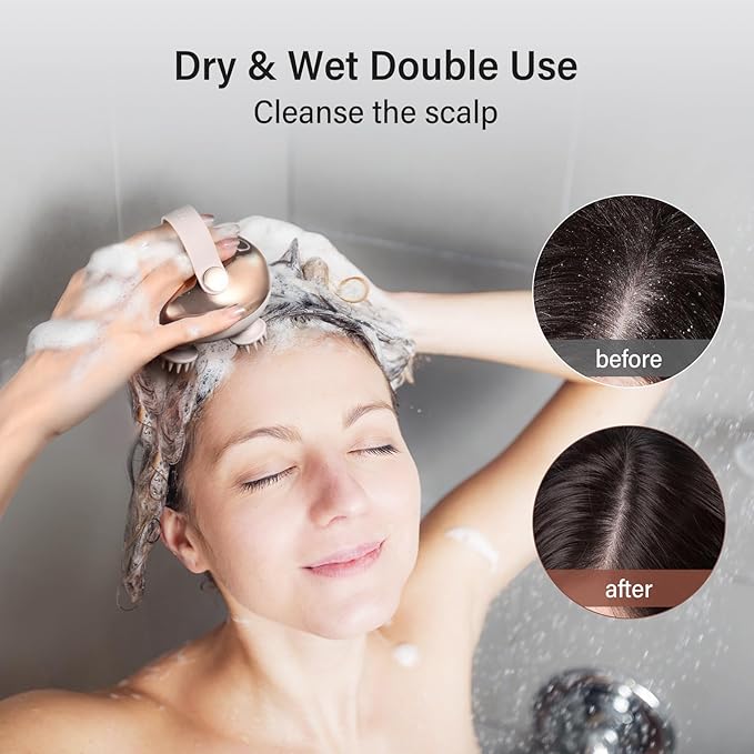 arboleaf Scalp Massager Kneading Head Massager Scalp Stress Relax Portable Rechargeable Hair Massager Shower Massage Waterproof Cat Massager Scratcher,Gift for Mom Dad-BrightBean Baby