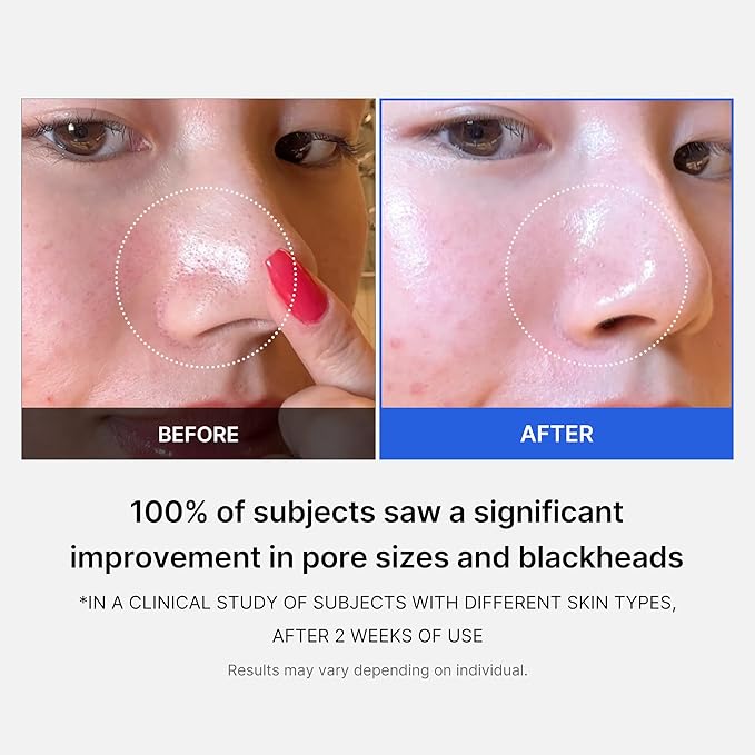 Medicube All-in-One Duo for Pore and Skin Texture Care: Zero Pore Pads 2.0 and Zero Pore Blackhead Mud Facial Mask-BrightBean Baby