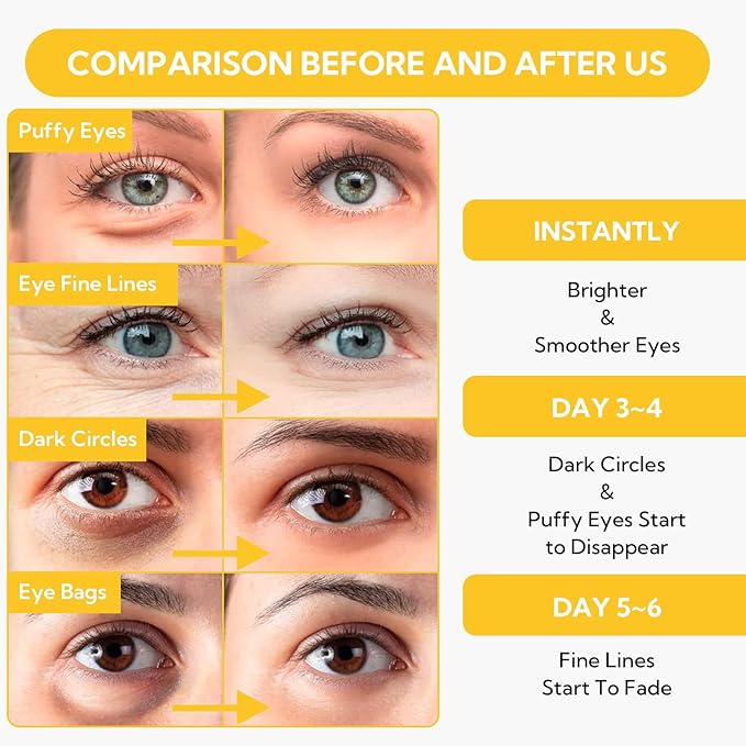 LANBENA 24K Gold Under Eye Patches(30 Pairs) -Cooling Eye Masks for Fine Lines Reduce, with Caffeine Niacinamide Tetrapeptide Hydra-Gel Collagen, Puffy Eyes & Dark Circles & Eye Bags Treatment-BrightBean Baby