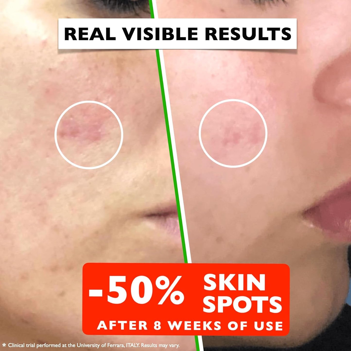 Vitamin C Serum For Face – Anti-Aging Facial Serum with Vitamin C, Hyaluronic Acid, Niacinamide, B5 & Vit E. Brightening Facial Essence for Dark Spots, Fine Lines, Wrinkles & Glowing Skin, 2 Fl Oz-BrightBean Baby