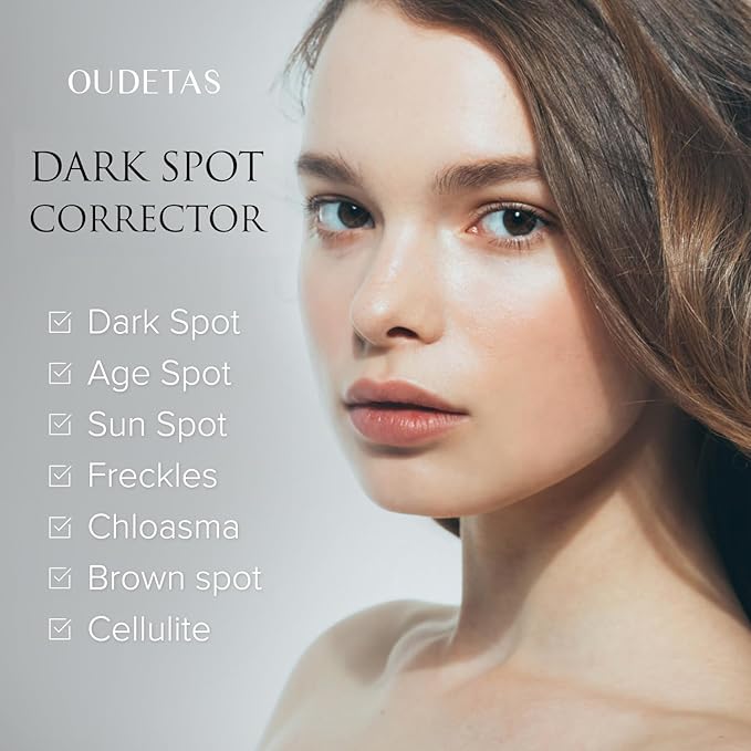 Dark Spot Remover for Face: Remove Sun & Age Spot Corrector – Melasma & Hyperpigmentation Brightening Serum for Body(Hand Leg Arm) – Brown Skin and Freckles Removal Treatment with Roller 15ml-BrightBean Baby