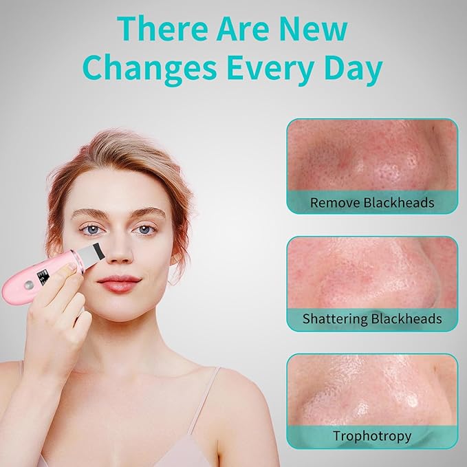 Skin Scrubber Facial Spatula - 4-in-1 Deep Cleansing Tool for Pore Extraction, Fast Charging Dock Blackhead Remover Face Spatula for Facial Skincare Women Gift (Pink)-BrightBean Baby