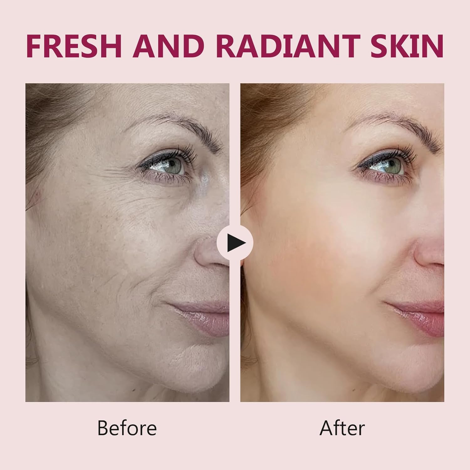 Salmon DNA Ampoule, Microneedling Serum, Anti-Wrinkle & Scar Removal for Face and Body, Salmon DNA Serum Ampoule Anti-wrinkle and Enhance Barrier Function-BrightBean Baby