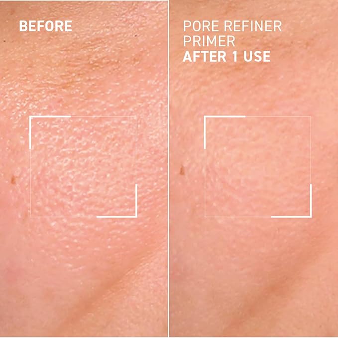 Dr. Brandt Pores No More, Pore Refiner Primer - Instantly Minimizes the Appearance of Pores, Absorbs Oil & Mattifies Shine - 0.5 fl oz-BrightBean Baby
