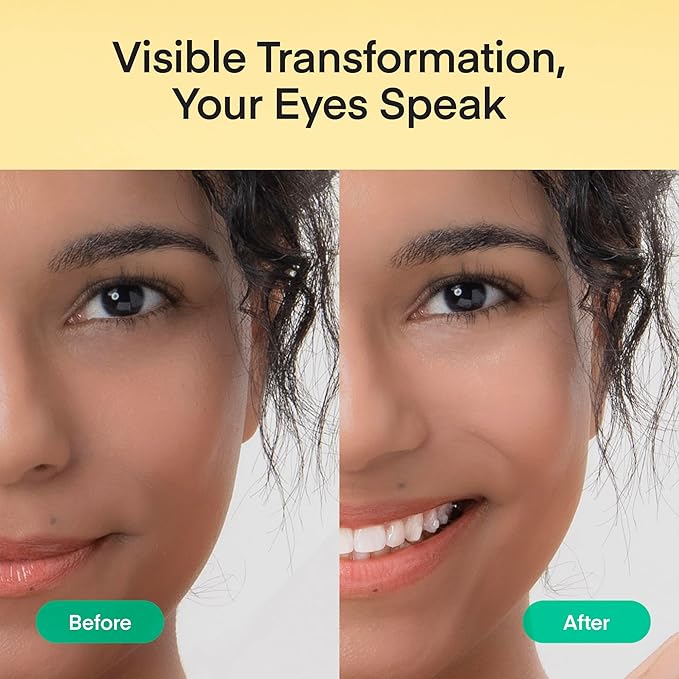 Terez & Honor Under Eye Patches - 180 Pcs Korean Self Care Hydrogel Eye Masks for Puffy Eyes, Dark Circles, Fine Lines, Wrinkles & Undereye Bags - Radiant Eyes Trio with Caffeine, Collagen & Vitamin C-BrightBean Baby