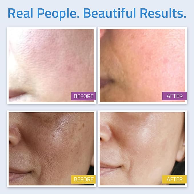 YEOUTH Skin Care Set: Retinol Serum with Hyaluronic Acid, Vitamin C & Super Face Serum, Cleanser, Toner, Eye Gel, Neck Cream, Face Cream 8-Piece Skincare Kit For Women-BrightBean Baby