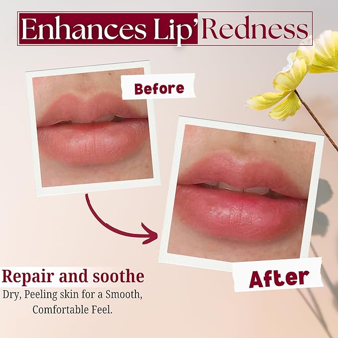 Merlena Pink Lip & Nip Serum - Hydrates and Repairs Dry, Peeling Lips and Nipples, Adds Collagen for Plumpness, Soothes Flaky Skin, Organic Vitamin C & E Formula 8ml-BrightBean Baby