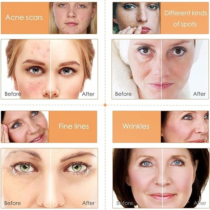 Vitamin C Skin Care Sets, 6Pcs Skin Care Products Set, Skin Care Gift Set for Women Girls, Hydrating Skincare Routine Set, Face Care Kit Includes Cleanser, Mask, Face Serum, Toner, Cream-BrightBean Baby