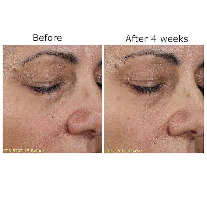 Daily Moisturizing Collection, Activator with Brightening Vitamin C+ Concentrate Starter, Hydrates & Brightens Face, Skin Care Rountine, For All Skin Type, Gift Bundle / Starter Kit-BrightBean Baby