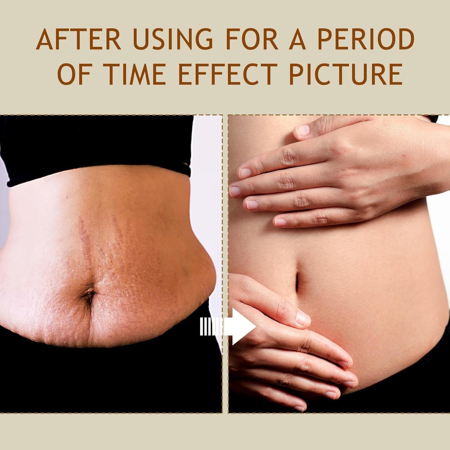 B Flat Belly Firming Cream - Stretch Mark Treatment - Clean and Gentle Belly Cream - Skin Tightening Cream for Cellulite for Stomach Mark & Thighs & Butt, Moisturizing Lifting Body Lotion-BrightBean Baby