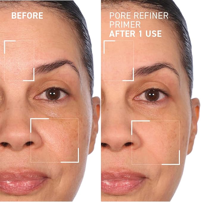 Dr. Brandt Pores No More, Pore Refiner Primer - Instantly Minimizes the Appearance of Pores, Absorbs Oil & Mattifies Shine - 0.5 fl oz-BrightBean Baby