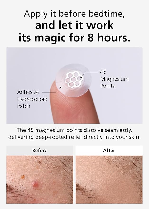Quick Calming Magnesium Patches(20 patches) with Cica Ampoule - Intensive Care, Pimple patches, Hydrocolloid Band, Zits Spot care Overnight Home Care 2-8 hours, New boxs types-BrightBean Baby