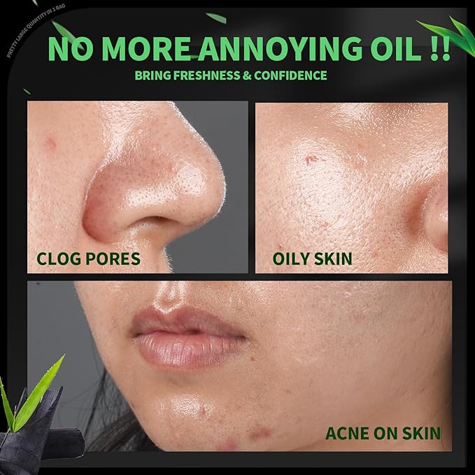 Blotting Paper for Oily Skin, Natural Bamboo Charcoal Blotting Paper, Oil Blotting Sheets for Face, 100 * 70MM Large Oil Absorbing Sheets Makeup Face Tissues, 200 Counts-BrightBean Baby