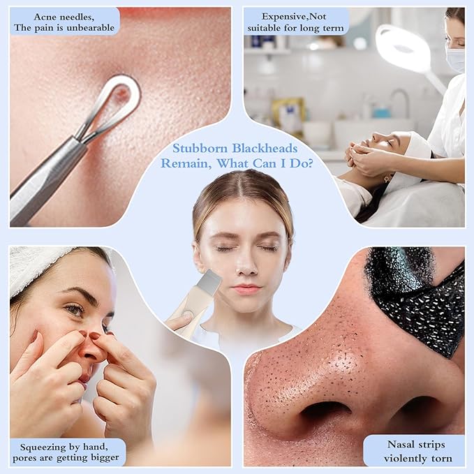 Skin Scrubber Face Spatula Skin Spatula Pore Cleaner Blackhead Remover Tools for Facial Deep Cleansing Skin Care Tool for Men and Women (Beige)-BrightBean Baby