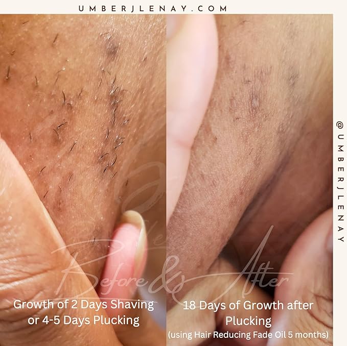 Hair Reducing Fade Oil – Regular Strength (Not sensitive skin), Minimizes Hair Growth for Face & Body – For Women & Men – 15ml Serum-BrightBean Baby