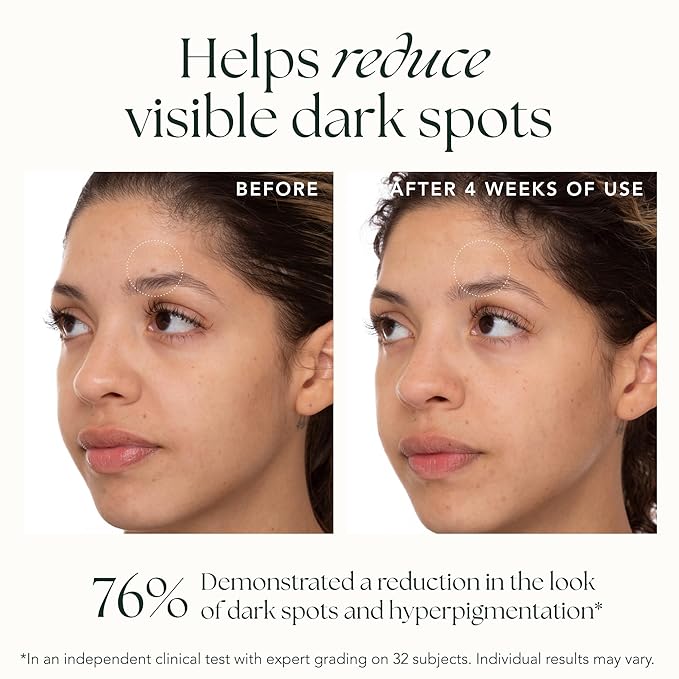 Brightening Saffron Serum - Discoloration Correcting Face Serum, Dark Spot Corrector, Vitamin C Alternative & Hyperpigmentation Treatment - Leaves Skin with a Healthy Glow (1 oz)-BrightBean Baby