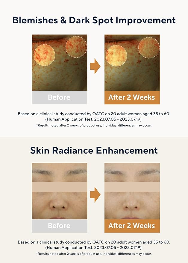 AROMATICA Glow Vita C Toning Serum Orange & Neroli 30ml/1.01 fl. oz - Orange Vitamin C Serum for Face with Hyaluronic Acid For Sensitive Skin-BrightBean Baby