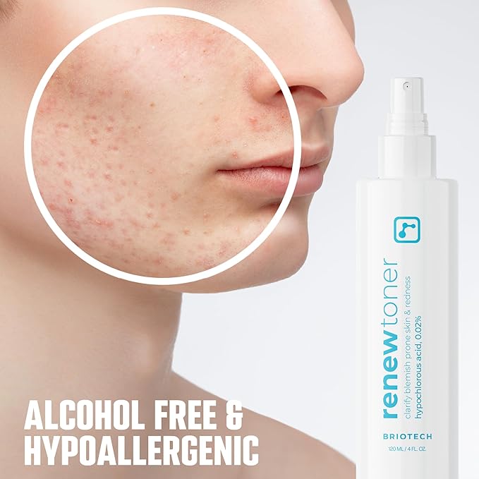 BRIOTECH Skin Renew Toner, Hypochlorous Acid Spray Topical Skin Spray for Face and Skin, Minimize Appearance of Blemishes, Soothing Mist for Redness & Bumps, 4 fl oz ea, 4 ct-BrightBean Baby