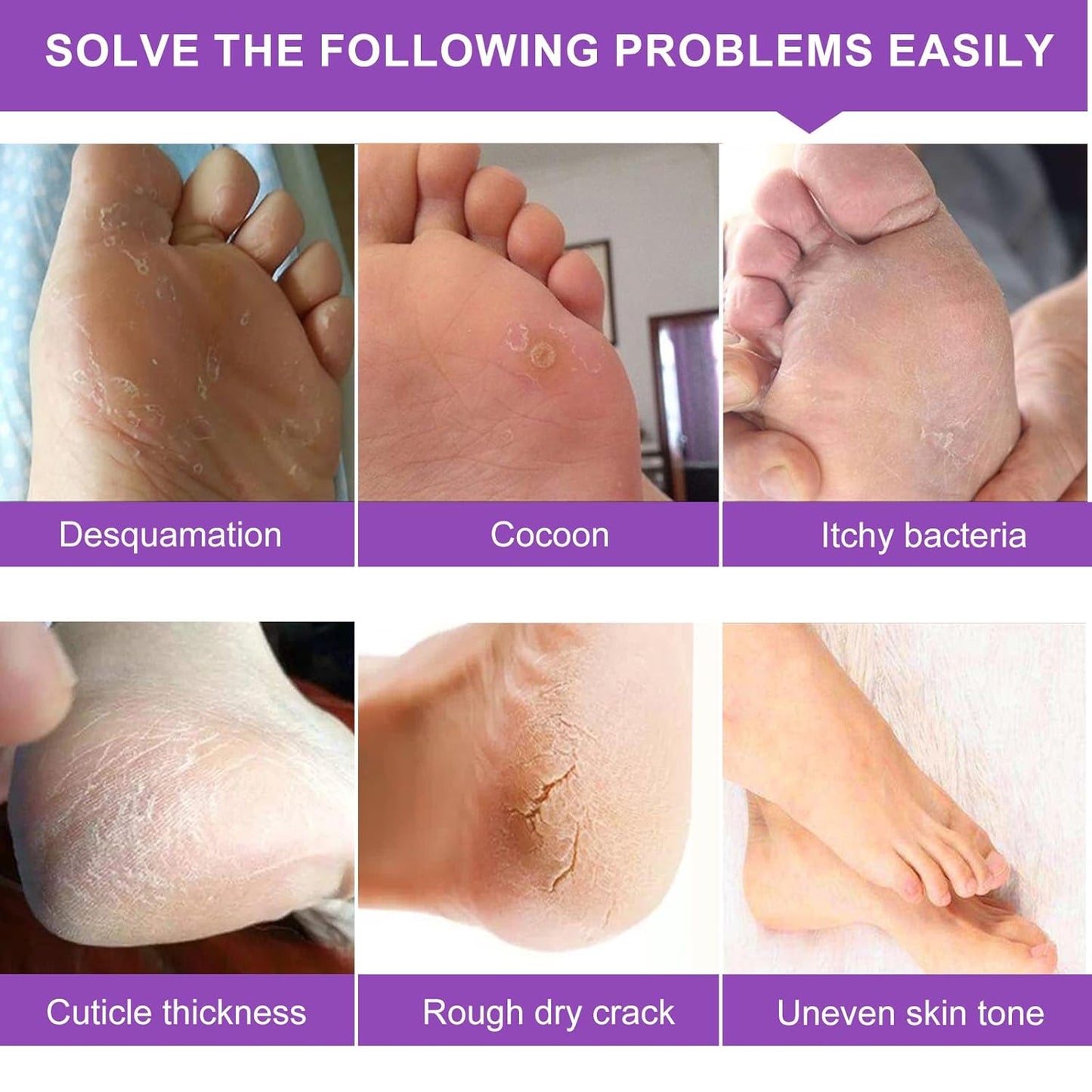 Foot Peeling Mask 5 Pack, Moisturizing Socks for Dry Foot Care, Hydrating Feet Peel Masks Repair Dry Cracked Heels, Remove Dead Skin,Callus - Women Men (Lavender)-BrightBean Baby