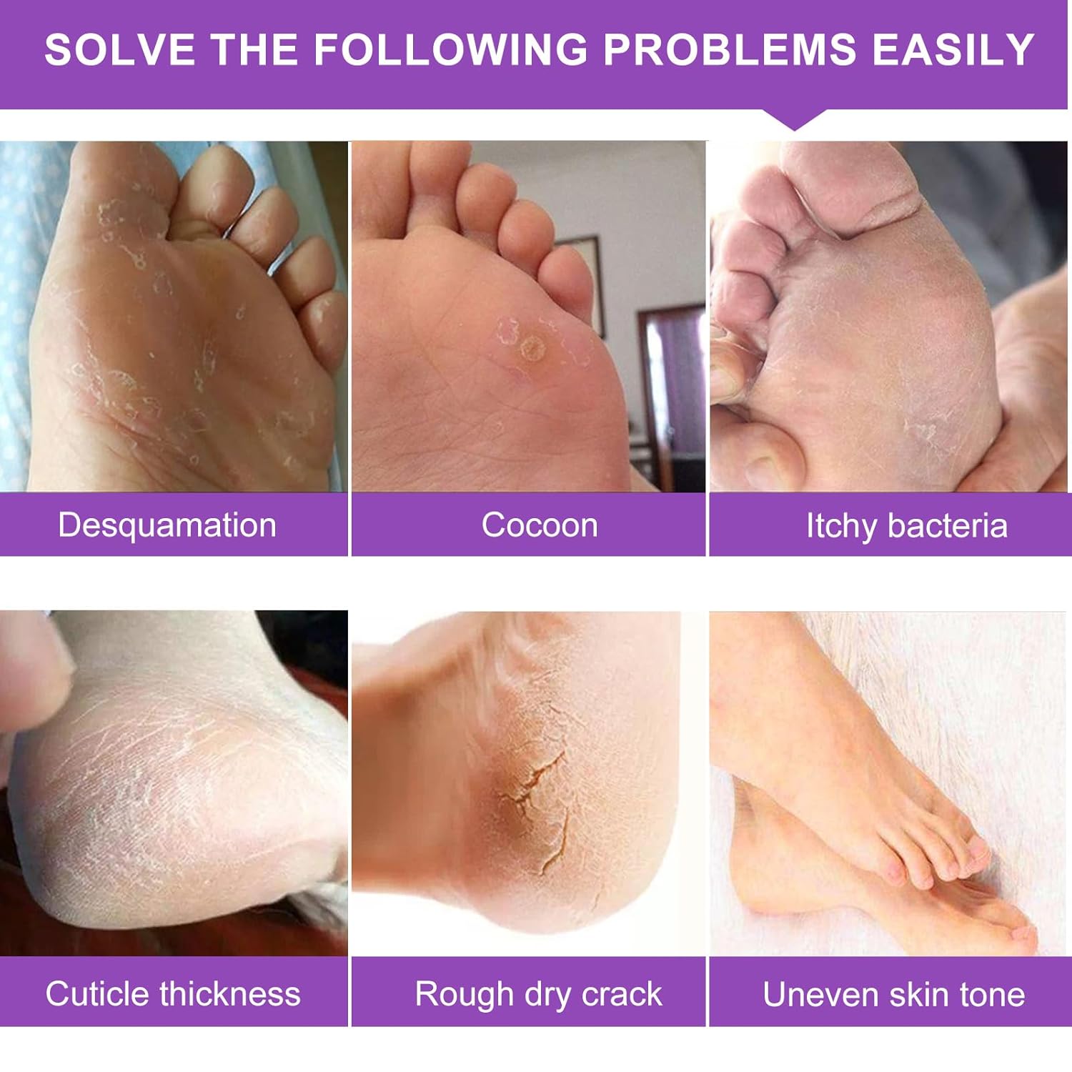 Foot Peeling Mask 5 Pack, Moisturizing Socks for Dry Foot Care, Hydrating Feet Peel Masks Repair Dry Cracked Heels, Remove Dead Skin,Callus - Women Men (Lavender)-BrightBean Baby