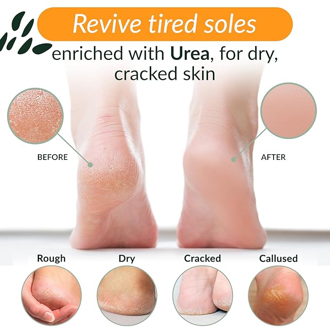 Tree to Tub Foot Cream for Dry Cracked Heels and Feet - Foot Lotion for Dry Cracked Feet, Non-Greasy Moisturizer Urea Cream w/Softening Shea Cocoa Butter, Citrus Foot Care for Women & Men-BrightBean Baby