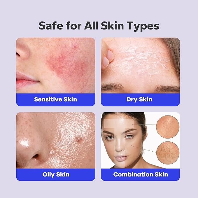Salicylic Acid Spray (5.07 Fl Oz), 2% Salicylic Acid Body Spray, Body Acne Treatment for Bacne, Blackheads & Blemishes, Back & Chest Acne Spray for Face & Body, 360° Mist for All Skin Types-BrightBean Baby