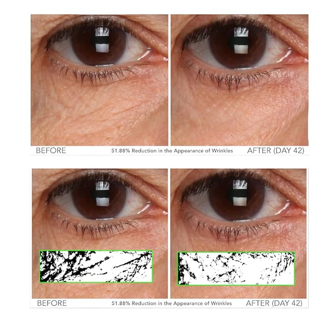 Serious Skincare - C3 Vitamin C Ester Eye Beauty Treatment with Hyaluronic Acid - For Dull & Dry Under Eyes - Soothing C3 Plasma Gel Formula for Fine Lines, Wrinkles, Discoloration - 0.5 oz.-BrightBean Baby