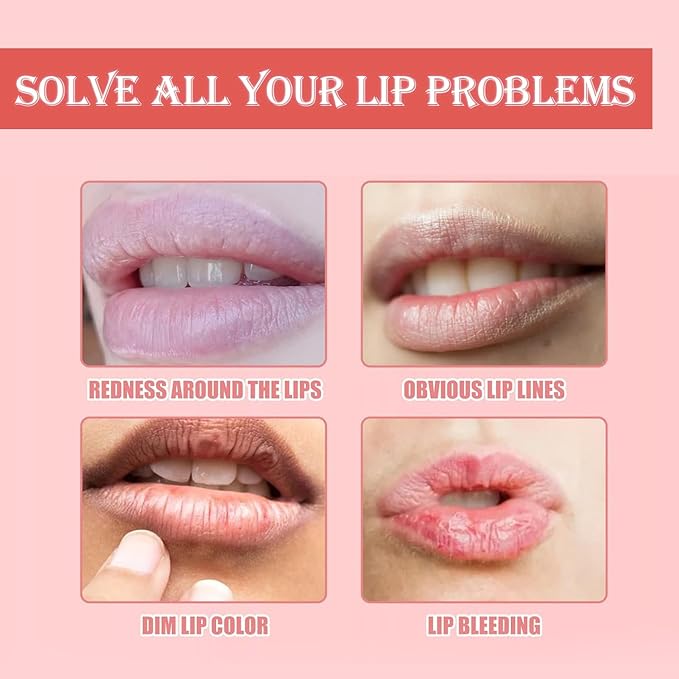 3 PCS Bee Lip Balm Honey Pot, Exfoliating Honey Strawberry Watermelon Lip Mask Overnight with Built-In Brush, Hydrating Prevention Dry and Crack Lip Scrubs Exfoliator Lip Wrinkle Care-BrightBean Baby