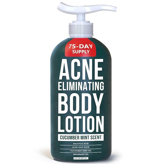 TreeActiv Acne Eliminating Body Lotion 8 fl oz | Clears Body, Back, Butt and Shoulder Acne | Anti-Acne Moisturizer | Prevents Future Breakouts | Cucumber Mint Scent-BrightBean Baby