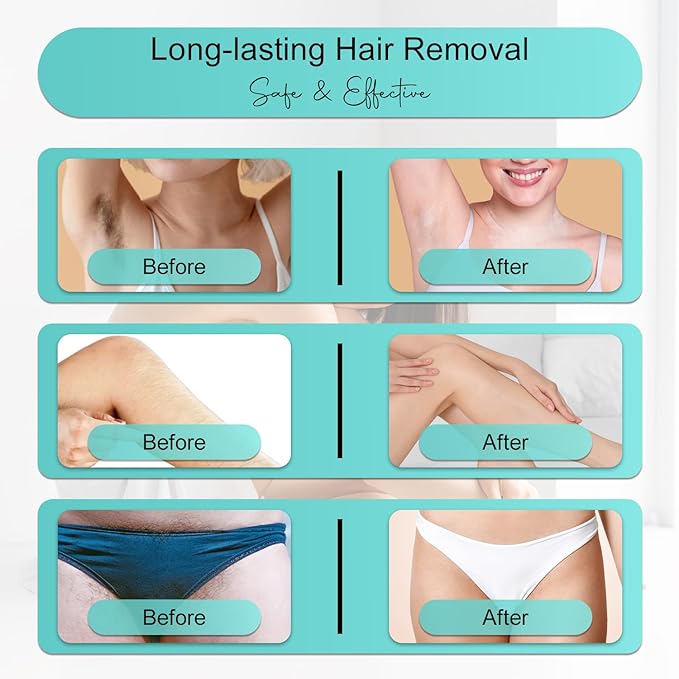 Professional IPL Laser Hair Removal Device & Epilator for Women and Men, 999,999 Flashes, Permanent Hair Reduction for Face, Legs, Arms, Bikini Line & Body, Painless Treatments for Smooth Skin at Home-BrightBean Baby