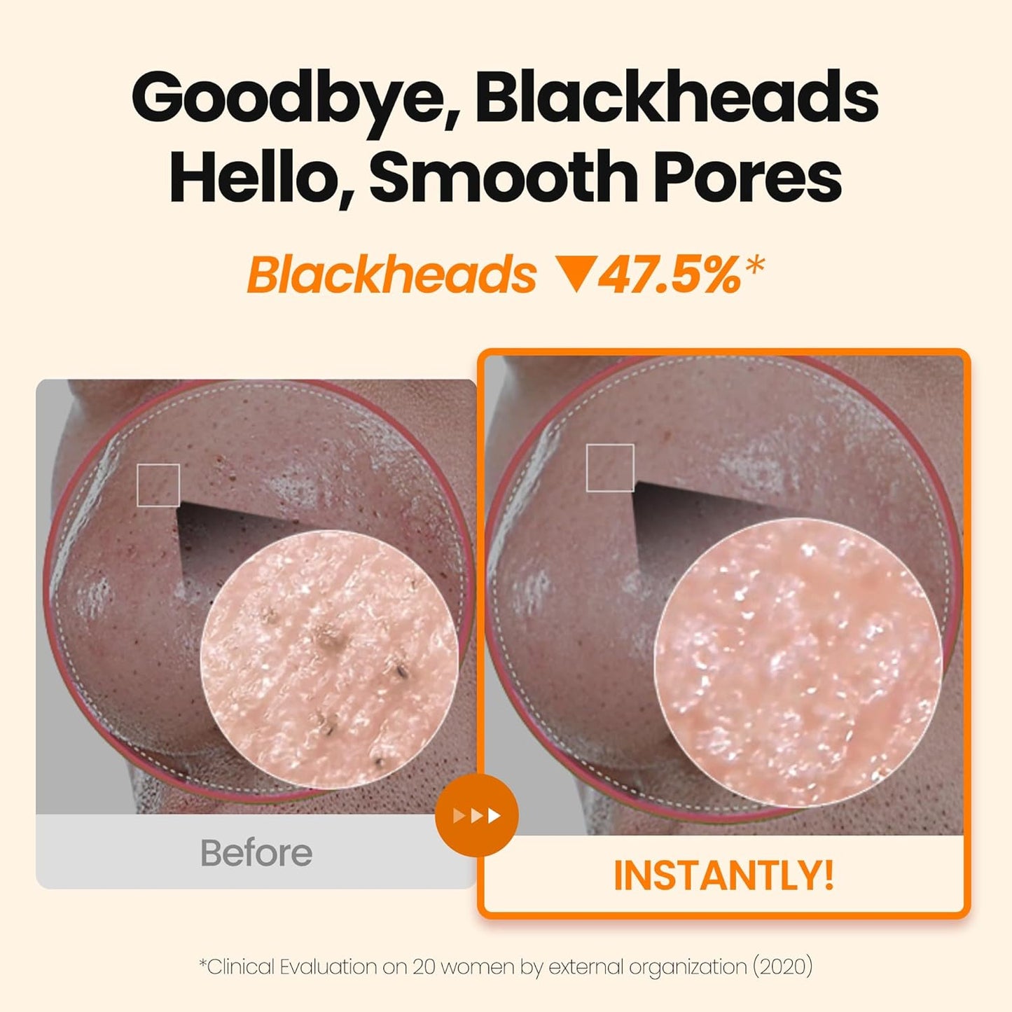 [K-Beauty] Calendula Biome Oil to Foam - All-in-One Korean Face Wash OilBased Foaming Facial Cleanser - Hydrating, Moisturizing & Soothing Makeup Deep Cleansing Oil for All Skin Types (3.88 fl oz)-BrightBean Baby