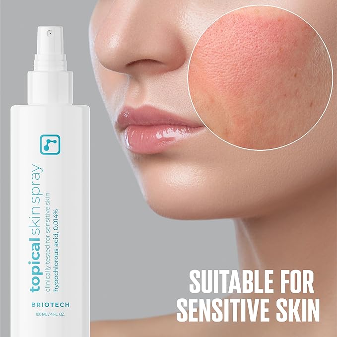 BRIOTECH Topical Skin Spray, Hypochlorous Acid Spray for Sensitive Skin, HOCl Facial Mist, Full Body Support Against Irritation, Calm Redness, Soothe Foot & Scalp, 2 oz Travel Size-BrightBean Baby