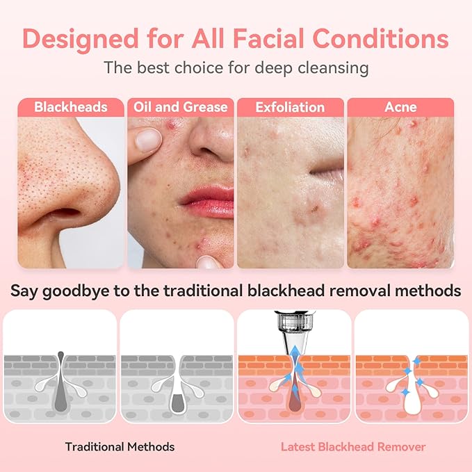 Blackhead Remover Pore Vacuum Upgraded Facial Pore Cleaner Electric Comedone Whitehead Extractor Tool-5 Suction Power,5 Probes,USB Rechargeable Blackhead Vacuum Kit for Women & Men-BrightBean Baby