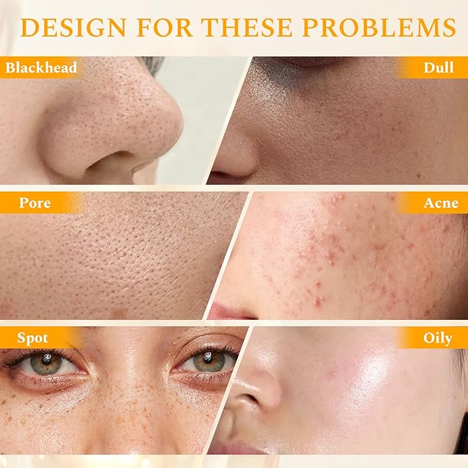 Vitamin C Face Scrub Face Exfoliator Cream Brightening Facial Scrub Exfoliating Facial Wash Microdermabrasion Facial Scrub, Gently Exfoliate Dirt and Dead Skin Cells, Improve Dark Spot, 140g/5oz-BrightBean Baby