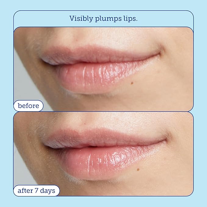 Skinfix Barrier+ Triple Lipid Lip Treatment: Nourish Dry, Chapped Lips With Our Volumizing Complex to Visibly Plump & Fill Fine Lines, 0.27 Oz-BrightBean Baby