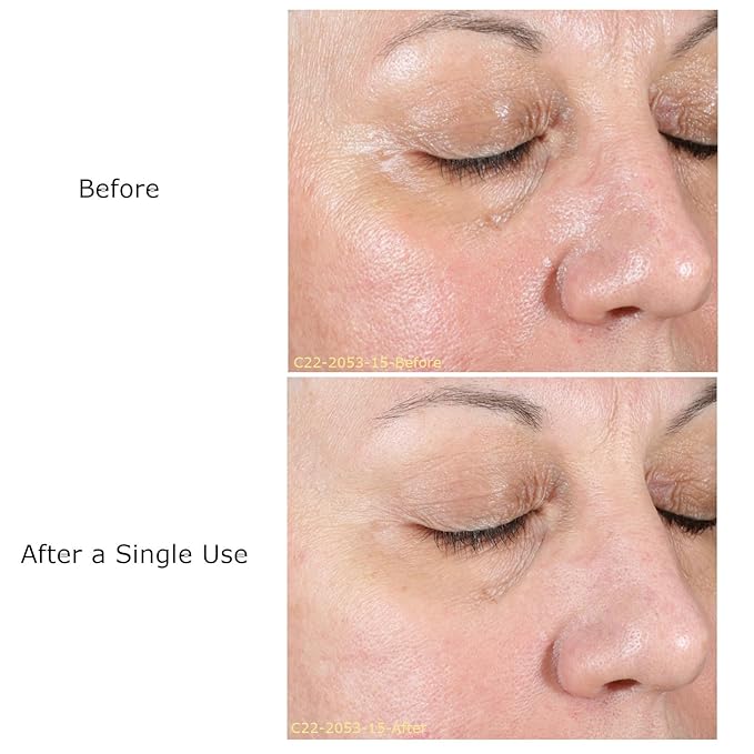 Smooth & Brighten System Collection, Activator with AHA Facial & Vitamin C Concentrate, Skin Renewal Trio, Skin Care Routine,Suitable for Dry Skin, Gift Bundle / Starter Kit-BrightBean Baby