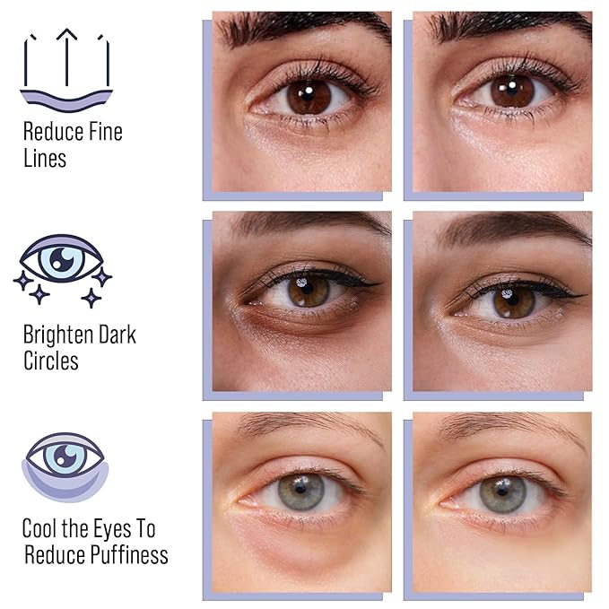 DIAMOND GAZE Under Eye Patches 28 Pairs, Rejuvenate Eye Area, Soothing Hydrate Brighten Skin, Plumps Fine Lines, Hydrogel Eye Mask with Retinol, Niacinamide and Polyglutamic Acid, Eye Gel Pads-BrightBean Baby