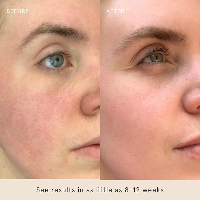 Barefaced Sheer Protection SPF 50+ – Broad-Spectrum Face Sunscreen for women with Zinc Oxide, Niacinamide & Hyaluronic Acid – Oil-Free UV Protection, Hydration & Anti-Aging with Universal Tint (60ml)-BrightBean Baby