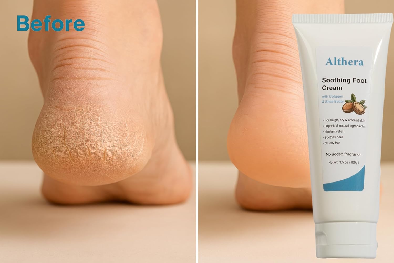 soothing Foot Cream with Collagen, Lactic Acid, Urea & Shea Butter – 3.5oz Intensive Repair for Dry Cracked Heels, Includes Moisturizing Sock for Overnight Hydration (full sock)-BrightBean Baby