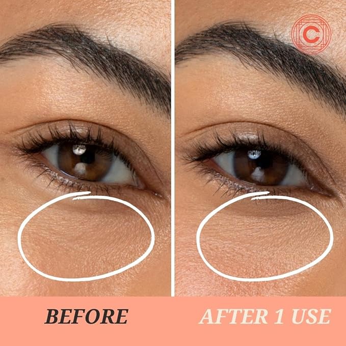 Lights On Brightening Dissolvable Eye Mask Infused with Red Algae, Vitamin C, Peptides, and Black Mulberry - Under Eye Patches for Wrinkles, Dark Circles, Puffiness, and Signs of Aging-BrightBean Baby